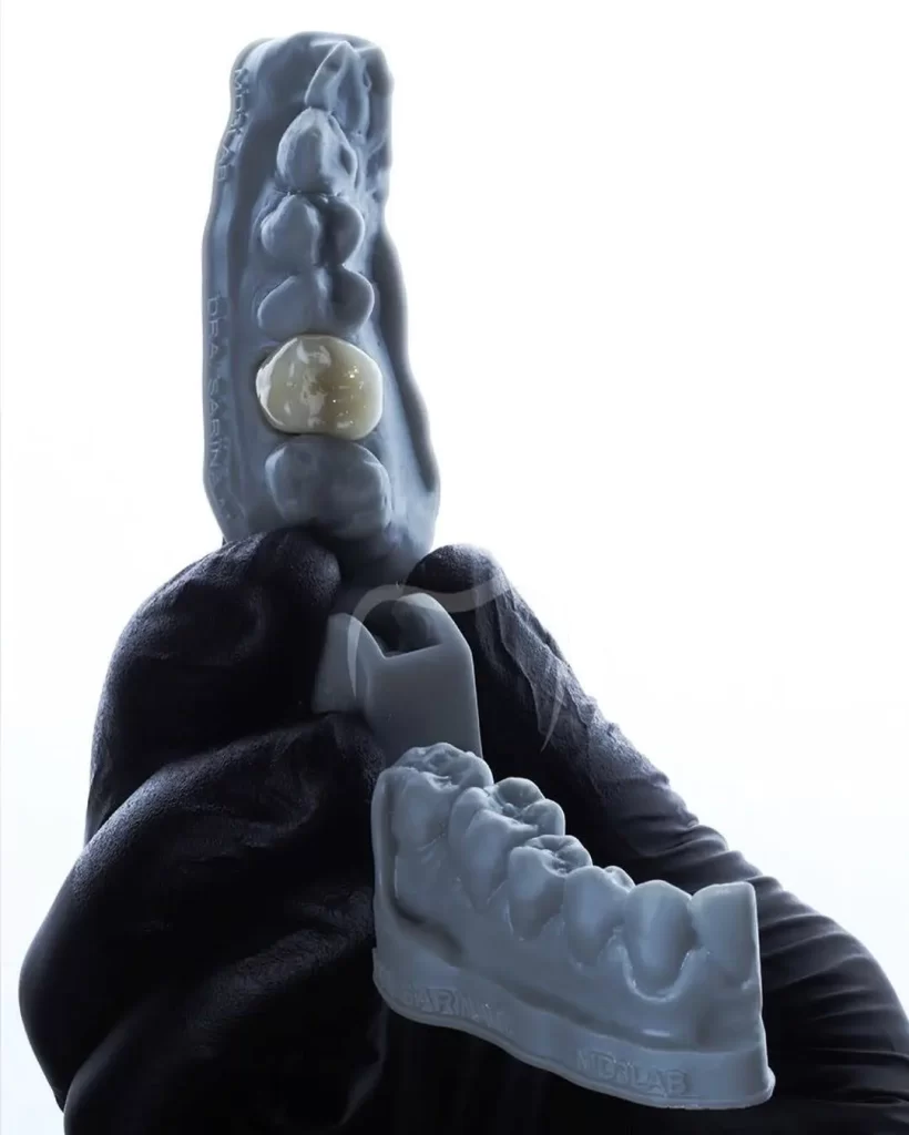 projeto de odontologia feita com resina para impressão 3d