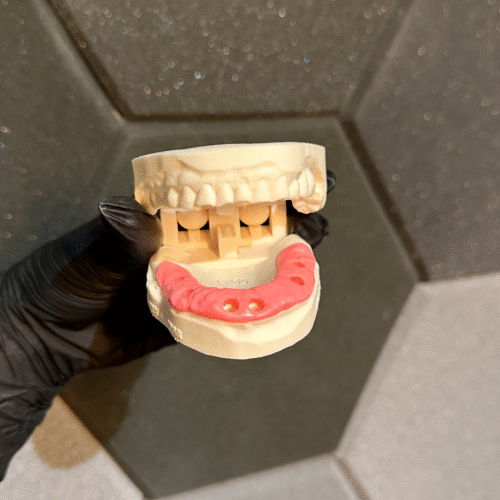 Kit Resina 3D Cure Gum 500g + Dental Model Marfim 1kg - Odontologia - Imagem 3